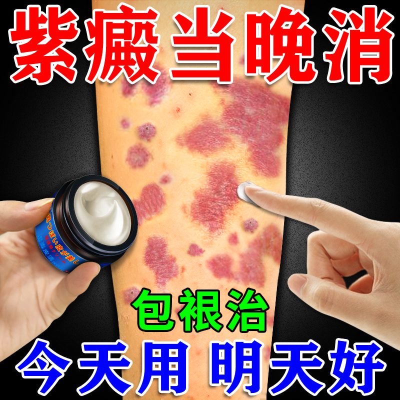 アレルギー性紫斑、皮下出血、赤斑、斑状出血、手足の血管炎などの治療に用いられる紫斑用特殊絆創膏