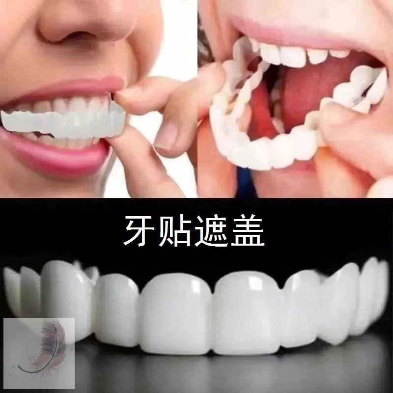 Tooth patch cover tooth slit large false tooth cover tooth simulation false tooth cog stitch filling Shenzer door aligner Big Tooth-Taobao