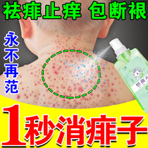 Prickly heat water for babies to relieve itching remove prickly heat and treat long-heated prickly heat for adults and children. Neck flooding bath spray