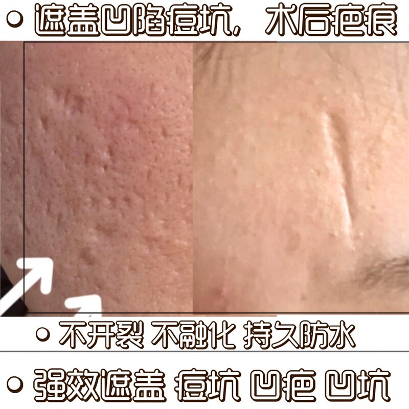 Film and Television Special Effects Makeup for Halloween, Quick-Drying Scar Cover for Facial Scars, Sunken Scars, Acne Pits, Fake Nose Bridge for Halloween Film and Television Special Effects Makeup for Halloween, Quick-Drying Scar Cover for Facial Scars, Sunken Scars, Acne Pits, Fake Nose Bridge for Halloween