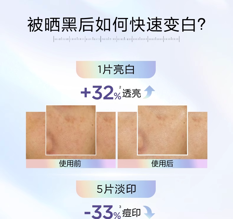 【香港直邮】 法国 巴黎欧莱雅 奶白面膜 烟酰胺美白淡斑面膜5片装 维C提亮补水保湿|熬夜急救去黄气|淡化痘印暗沉|敏感肌可用
