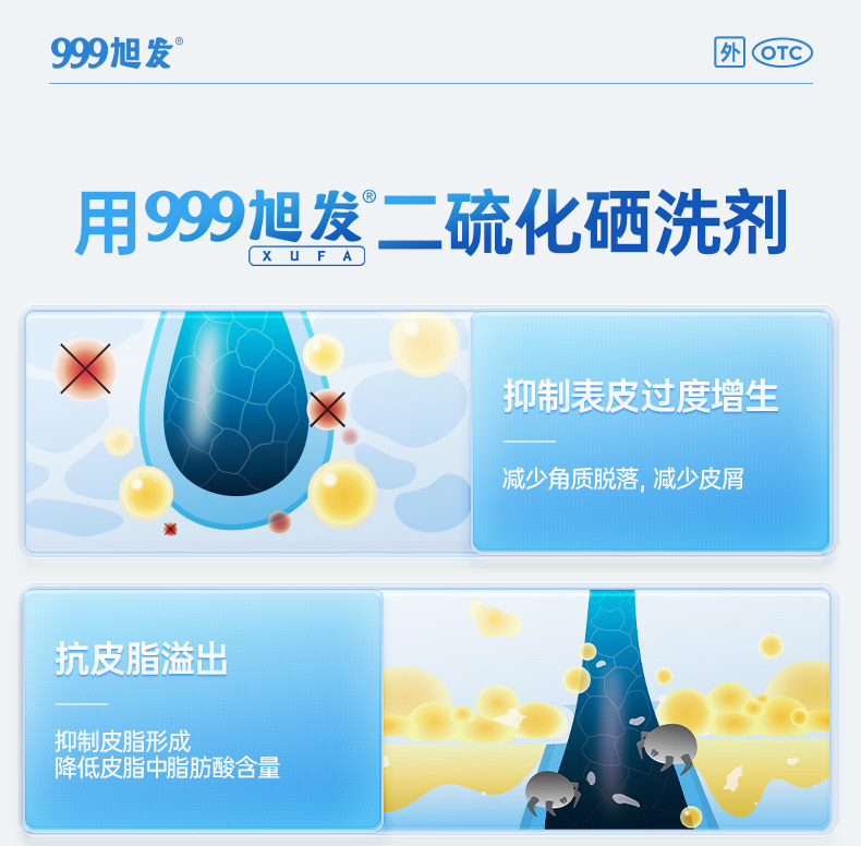999 二硫化硒洗劑 脂漏性皮膚炎 去頭皮屑 毛囊炎洗髮精 止癢 花斑 汗癬 150g*1瓶/盒