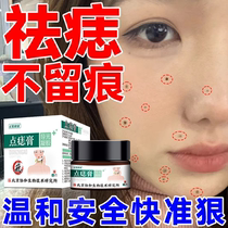 The mole cream removes the mole face to take mole spot to dedicate the mole mole mole spot dedicated artifact