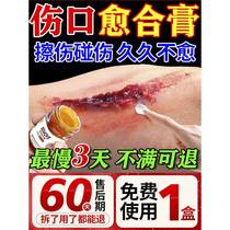 Wounds heal quickly scabs fall and break skin medicine childrens knee abrasion ointment leg and foot break skin wound anti-inflammation