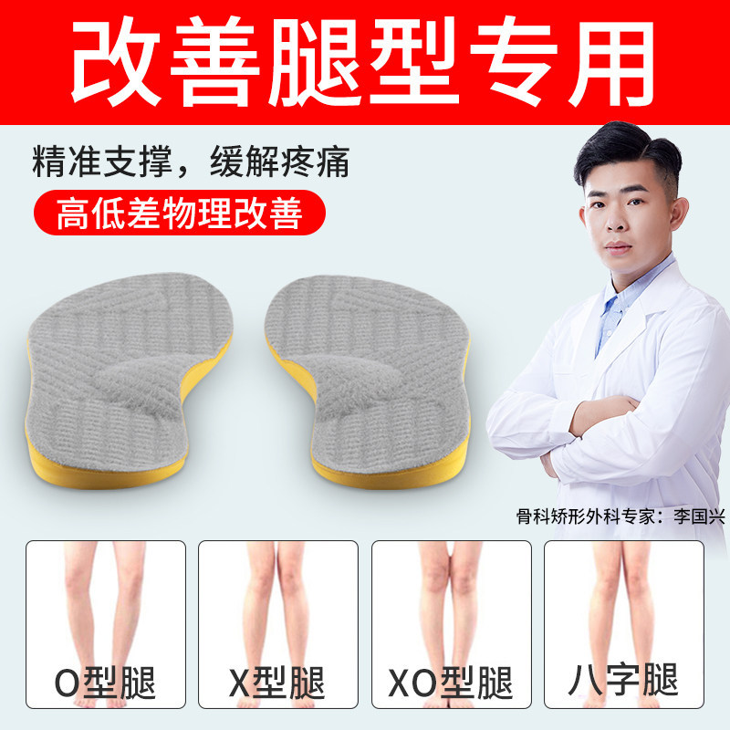 Adult Xo-Shaped Leg Correction Insoles for Correcting Foot Pronation and Eversion, Arch Support Insoles for Prolonged Standing Without Fatigue