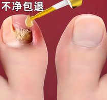 (Tongrentang hot sell) 7 days without pain for new potassium to enjoy a good A life Bad A to get a good jia drop a drop