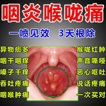 Japanese pharyngitis chronic exfoliation pharyngitis root cure special medicine foreign body sensation cough dry itching phlegm multi-follicle spray