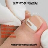Domestic 3to Patch Correction Patch Nail Correction Ingrown Nail Correction
