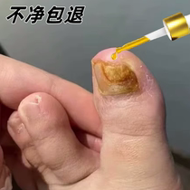 Pas couvert sans gouttes Une goutte deffet est trop bonne pour un mauvais ongle pour devenir une bonne A gris chia clair doigt clair réparation pour être un bon potassium ~