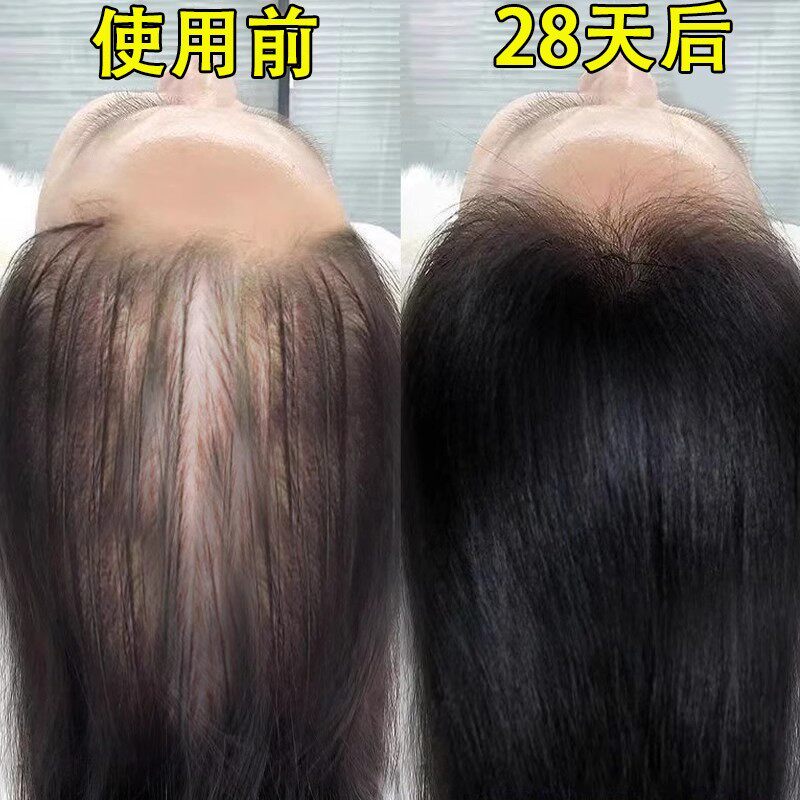 (short I eat) hair natural growth speed between men and women hair speed Mie-Taobao