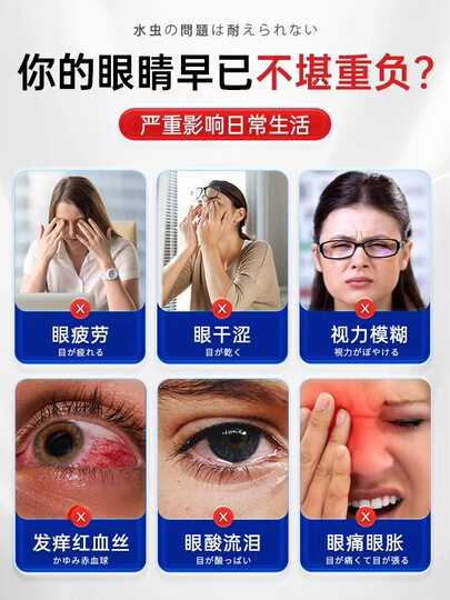 干眼症专用眼药水特效滴眼液药缓解眼睛疲劳干眼涩视力模糊看不清