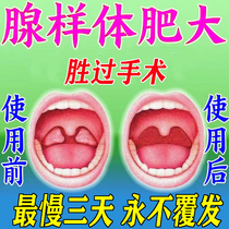 The fastest three days gland - like fat Chinese medicine paste conditioning the nose plug children sleeping open their mouth to snore