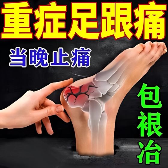 발 뒤꿈치 통증 발바닥 근막 통증 아킬레스 건 뼈 박차 밑창 발 뒤꿈치 통증 특수 연고 영역 유형을위한 특수 약