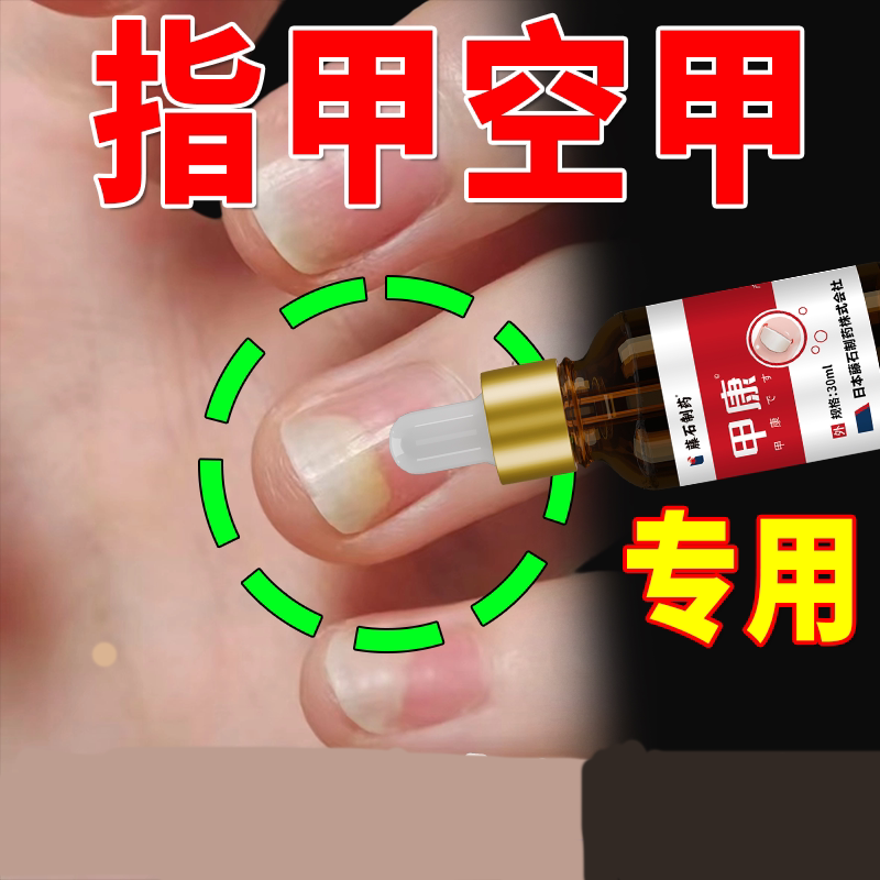 Nail Repair Solution for Separation of Nail and Cuticle, Fungal Infection, and Nail Repair Liquid, Specialized Medicine Wt Nail Repair Solution for Separation of Nail and Cuticle, Fungal Infection, and Nail Repair Liquid, Specialized Medicine Wt
