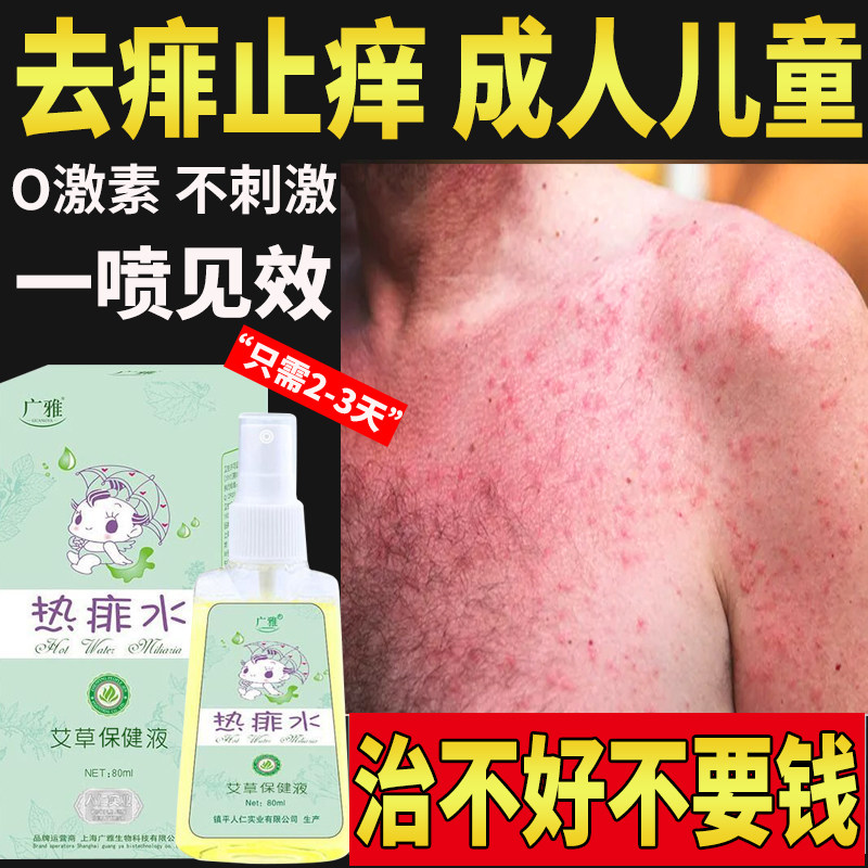 Heat prickly anti-itchy water adult Go to prickly spray to dispel the heat of the prickly cream anti-child disdain for the adult Divine Instrumental Powder Liquid apart-Taobao