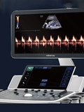 MindRay Color Doppler UltraSound System DC-35 Pro (сердечный стандарт) Цветный ультразвук B Ультразвук