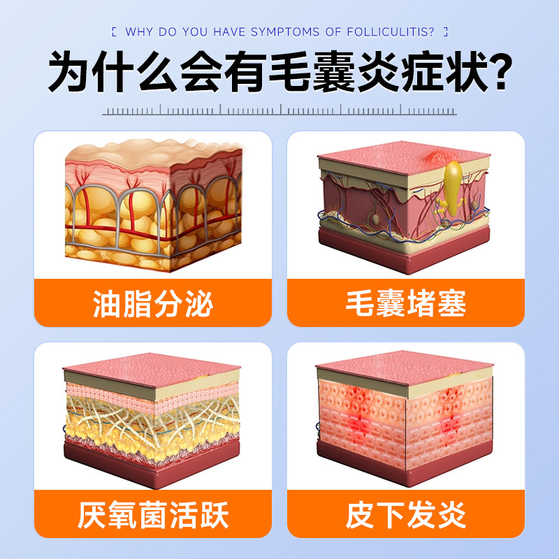 头皮毛囊炎&脂溢性皮炎,这些专业药膏帮你摆脱“头”等大事-皮脂汗腺-淘宝好物网