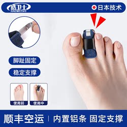 성인과 어린이는 발가락 발 발수가 겹치는 교정기를 망치게합니다