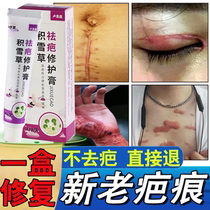 Scar removal cream specializes in repairing post-operative scars hypertrophic scars raised keloids depressed scars stretch marks and light scars