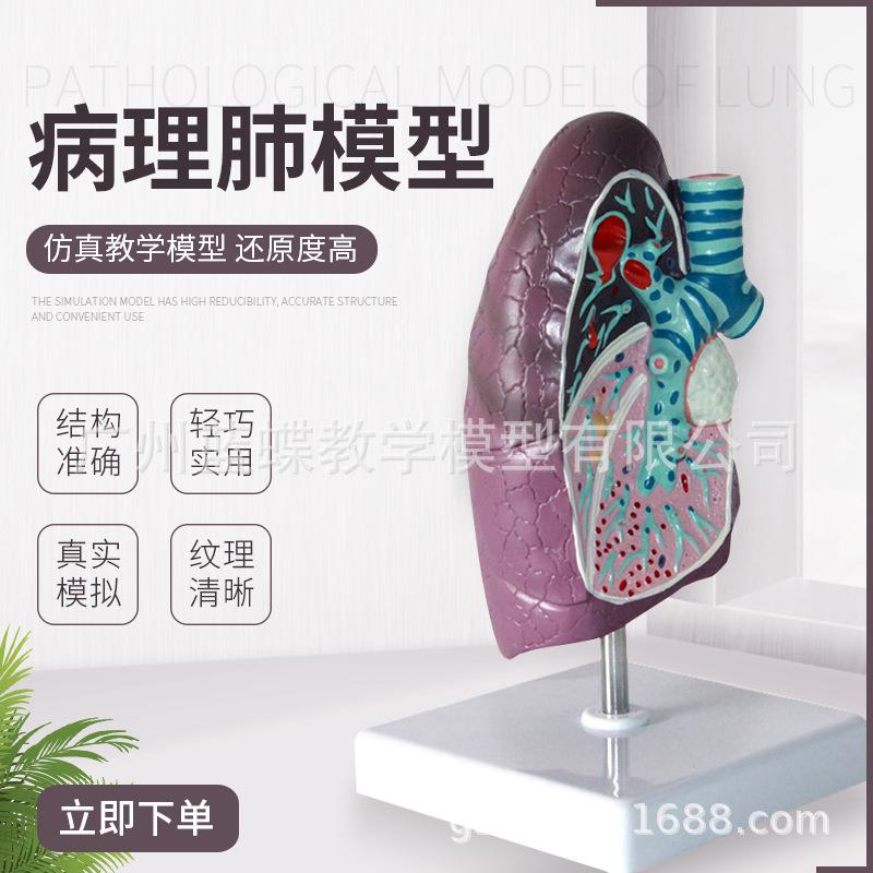 人体肺模型 病理肺解剖模型 呼吸系统 人体脏器模型 病变肺模型