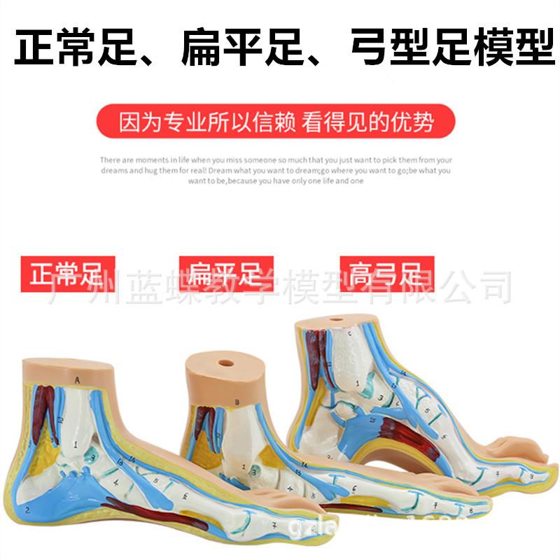 正常足 扁平足 弓型足 脚肌肉 足肌肉解剖 脚关节解剖骨骼 模型