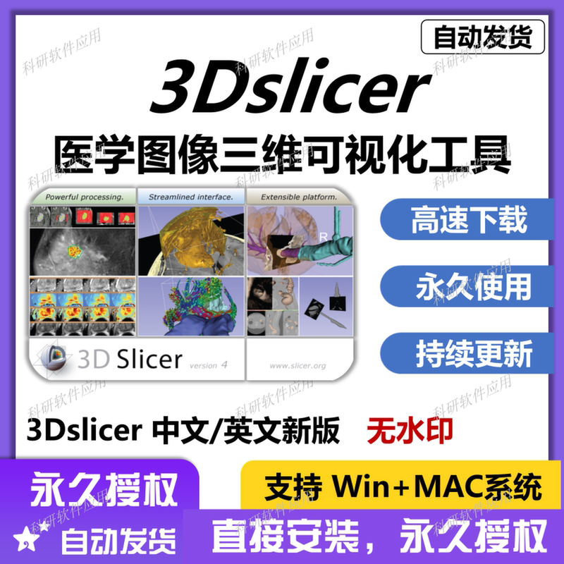 3D Slicer 3Dslicer Medical Image Three-Dimensional Visualization Analysis Feature Software Free Tutorial