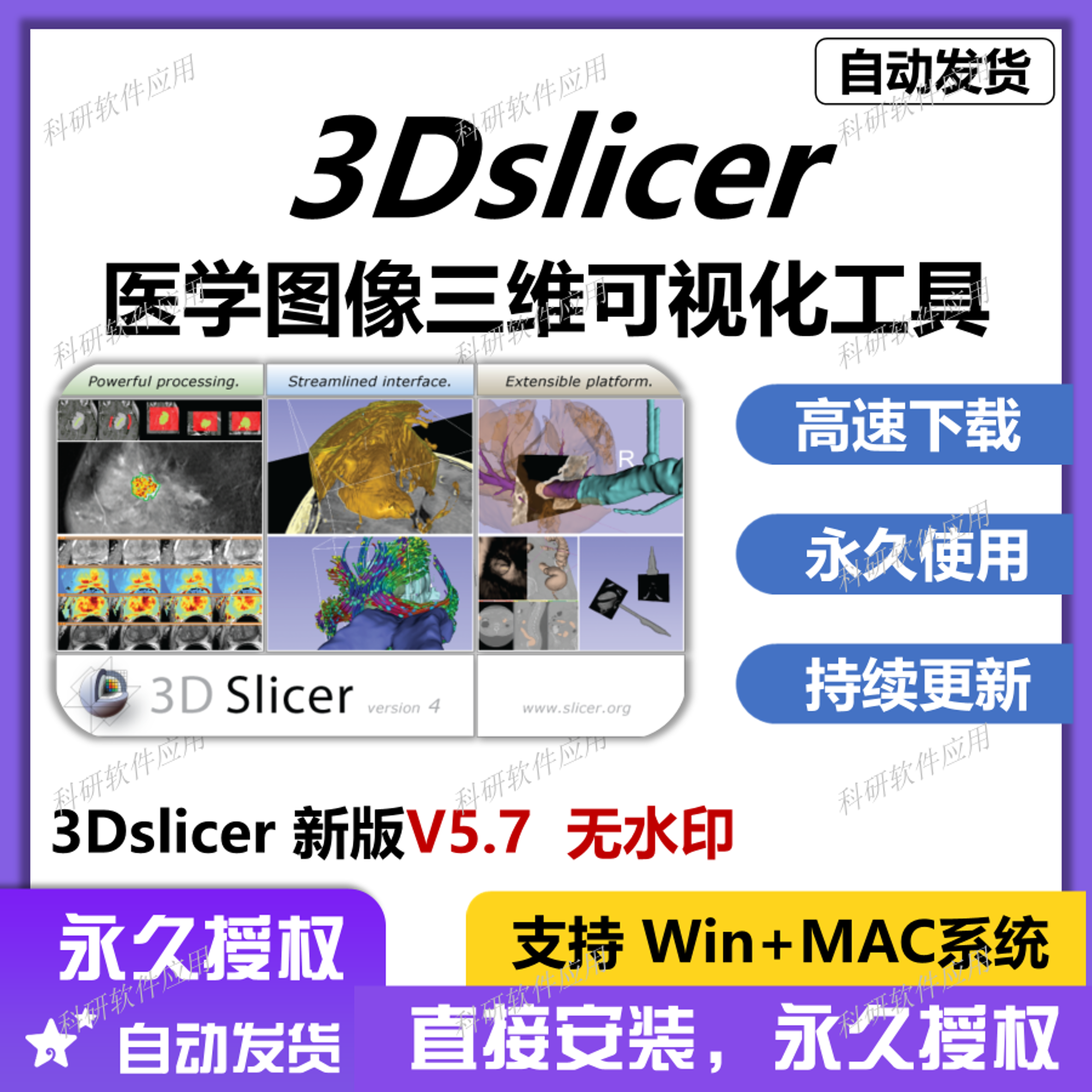3D Slicer 3Dslicer 医学图像三维可视化分析特征软件 赠教程