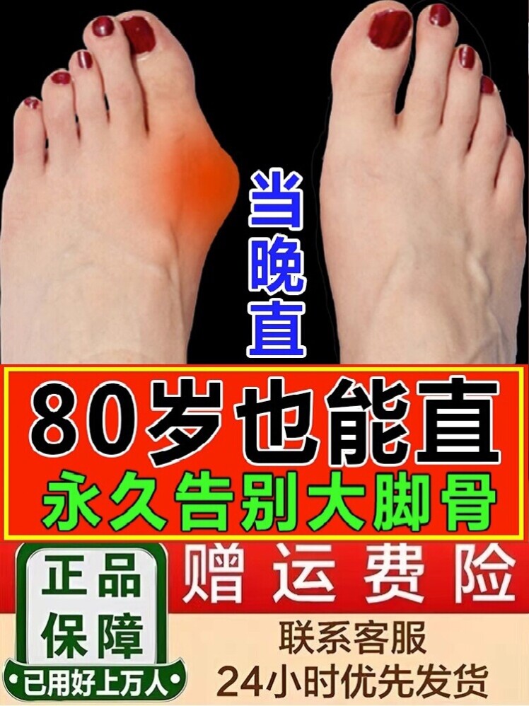 拇指外翻矫正贴足外翻纠正神器大脚骨防磨贴拇外翻脚趾专用膏XL