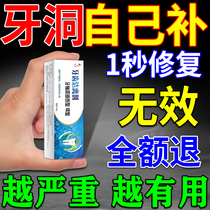 补齿洞膏补缝补神器自己在家填充蛀虫牙龋齿材料永久医用膏