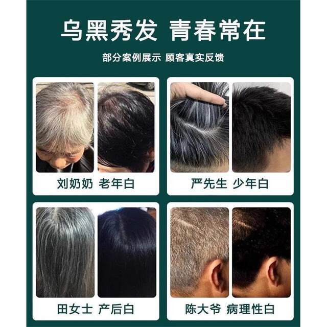 [Authentic North China Pharmaceutical Product]Two Capsules a Day - No Need to Worry about Thinning Hair - Suitable for Both Men and Women of All Ages