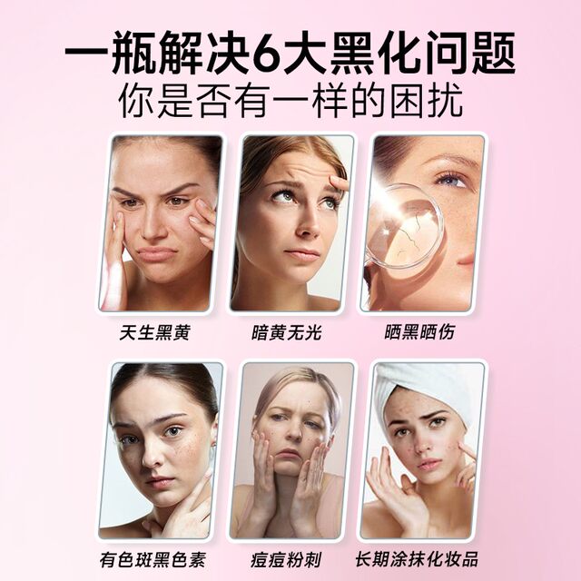 Whitening Pills for Internal Use, Brightening the Whole Body, Removing Yellow and Melanin Pigmentation, Grape Seed Tablets, Non-Glutathione, Skin Wrinkle Smoothing, Genuine Product