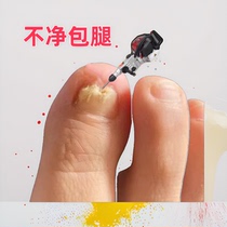 (Tongrentang hot sale) Painless replacement of potassium enjoy a good nail life turn bad nails into good ones drop by drop