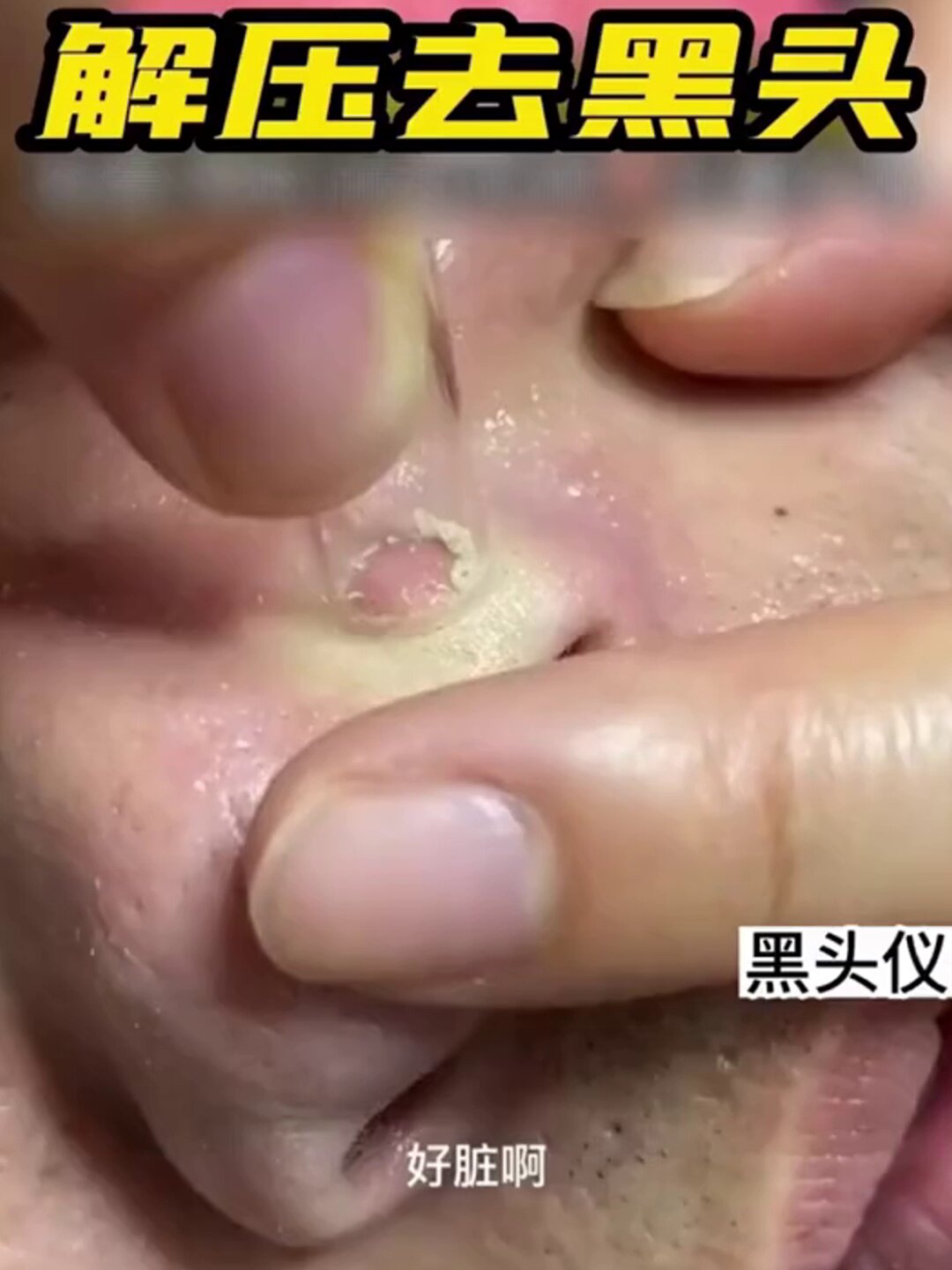 啊啊啊！这款神仙美容仪让我直接原地封神！_水光仪_淘宝美妆网