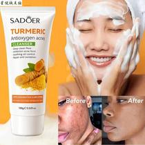 pSturmeric face cleanser wash gel blackhead acne spot facial cleanser