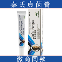 Official website Qins fungus cream Cream Foot Cream Private cream Smell Dry Foam stock Itch Feet off Foot Thigh