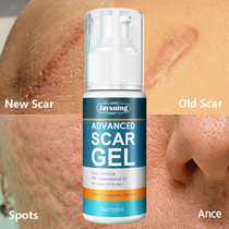 Advanced Scalar Remove Cream Acne Pimples Stch Marks Repair G
