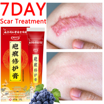 New Body Lightning Scar Cream Acne Spot Acne Ament White H