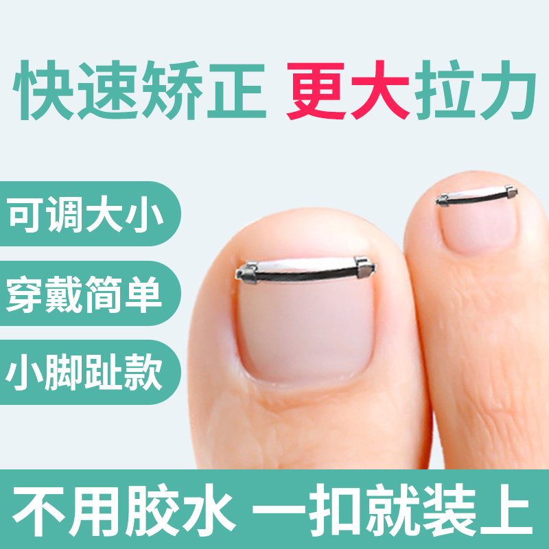 Ingrown Toenail Corrector, Nail Groove Corrector, Little Toe Nail Correction Tool, Nail Straightening Patch, Toe Nail Straightening Clip, Specialized Use