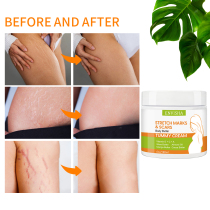 ENVISHA Women Body Care remove Stch Marks Cream Maternity Sc