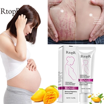 RtopR Pregnancy Scar Removal Cream Pregnant Women Pigment Co