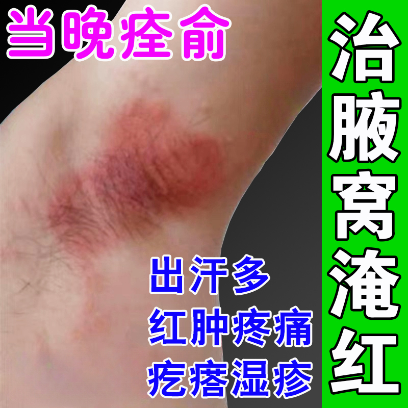 Redness in the Armpits, Prevention of Odor and Odor Removal, Prevention of Sweating, Redness, Pain, Itching, and Friction in the Armpits Redness in the Armpits, Prevention of Odor and Odor Removal, Prevention of Sweating, Redness, Pain, Itching, and Friction in the Armpits