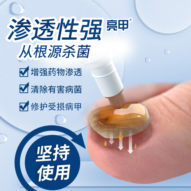 亮甲复方聚维酮碘搽剂:终结灰指甲,重塑美甲新“甲”遇!-癣症-淘宝百科网