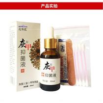 Niushijia Yikang Baibaicao external onychomycosis special medicine Guoxijiabenlingxilinbanmifeiyanxinjiashi