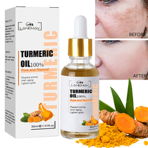 Turmeric Freckle Whitening Serum Fade Dark Spot Removal Pigm