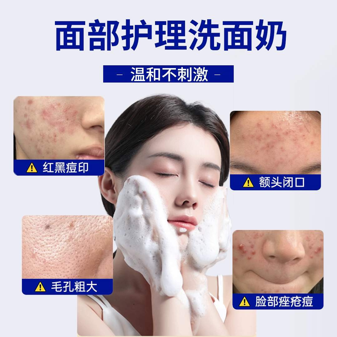 敏感肌必看！玫瑰痤疮洗面奶专用膏HT怎么测试？效果真的绝了？_护肤品推荐_淘宝美妆网