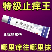 Quickly relieve itching Yunnan Fungus King external use for skin itching whole body dry itching anti-itching cream special antibacterial effect for skin itching