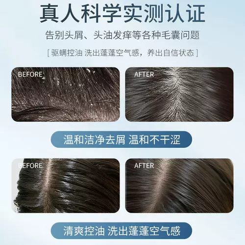 Парфюмированный лечебный шампунь для кожи головы подходит для мужчин и женщин, контроль жирного блеска, удаление перхоти, придает объем