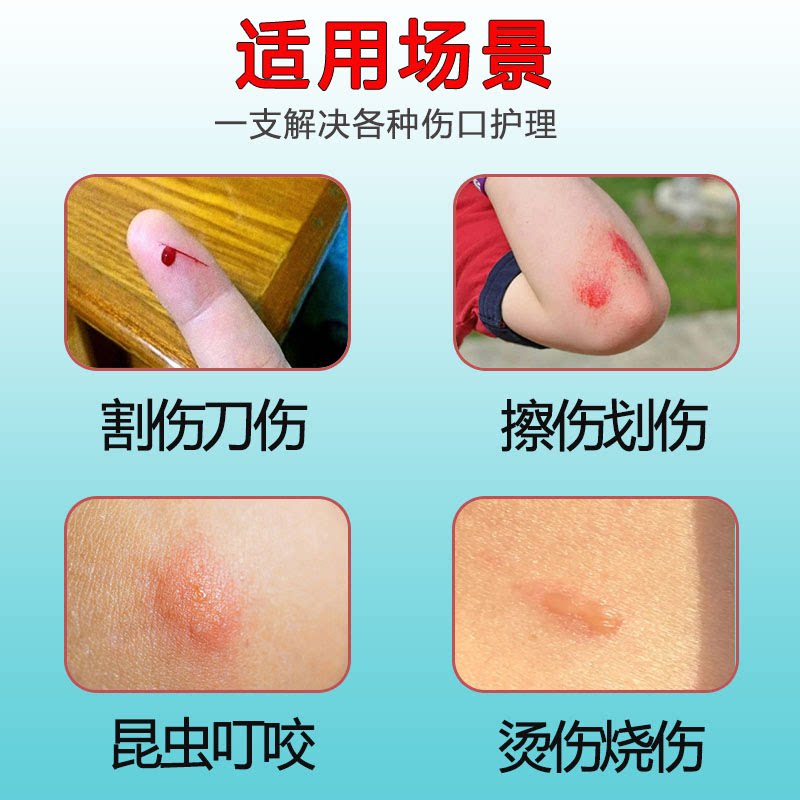 泰版bepanthen适合哪些人群使用？
