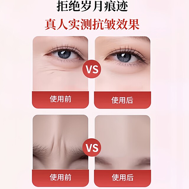 Japan's Sichuan pattern patch, anti-frowning artifact, forehead patch, lifting and tightening, special for sleeping, diluting nasolabial lines between eyebrows