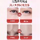 Japan's Sichuan pattern patch, anti-frowning artifact, forehead patch, lifting and tightening, special for sleeping, diluting nasolabial lines between eyebrows